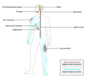 SLA neuroni e muscoli affetti